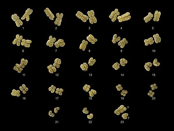Full set of male chromosomes, SEM