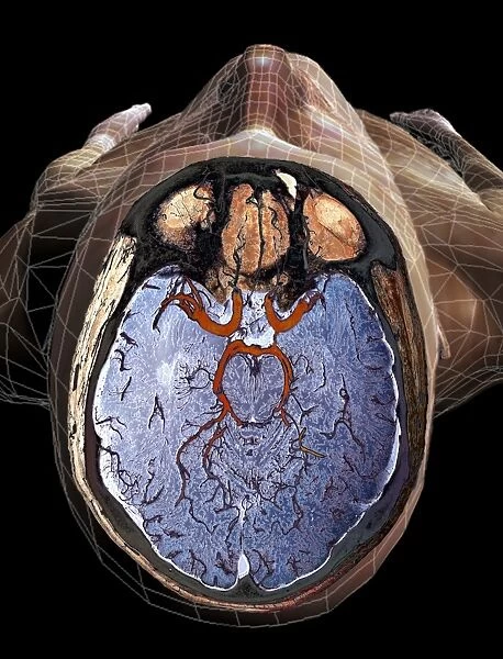 Brain blood supply, MRI scan C018  /  0432