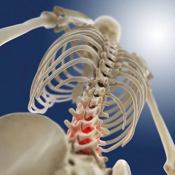 Lower back pain, conceptual artwork