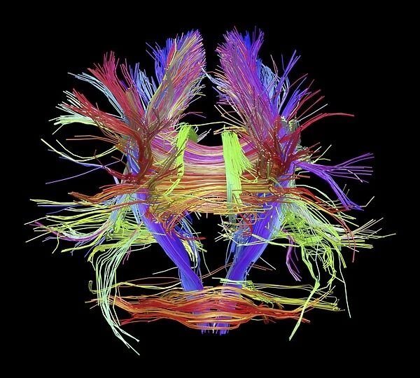 White matter fibres of the human brain C014  /  5664