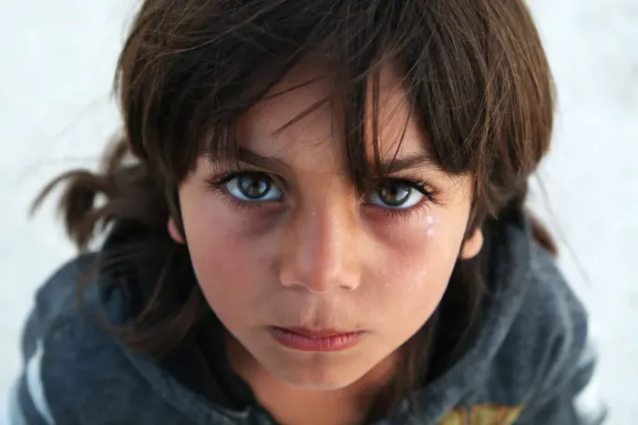 Framed Print : Syria-Child-Portrait-Eyes-Look Framed Print : Syria-Child-Portrait-Eyes-Look