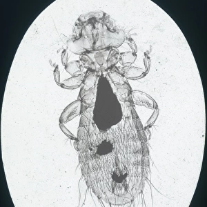X-Ray - Microscopic x-ray view of a small head louse