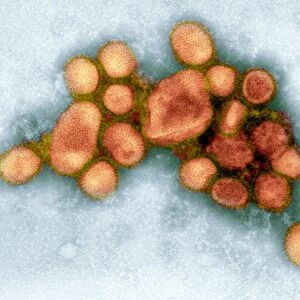 2009 H1N1 swine flu virus, TEM