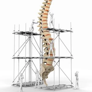 Spine with workers, spine repair F007 / 9884