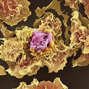 TB bacteria infecting macrophages, SEM