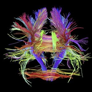 White matter fibres of the human brain C014 / 5664